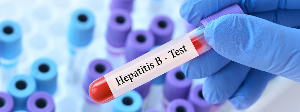 Assessing a Predictive Model for Reflex Hepatitis B Testing
