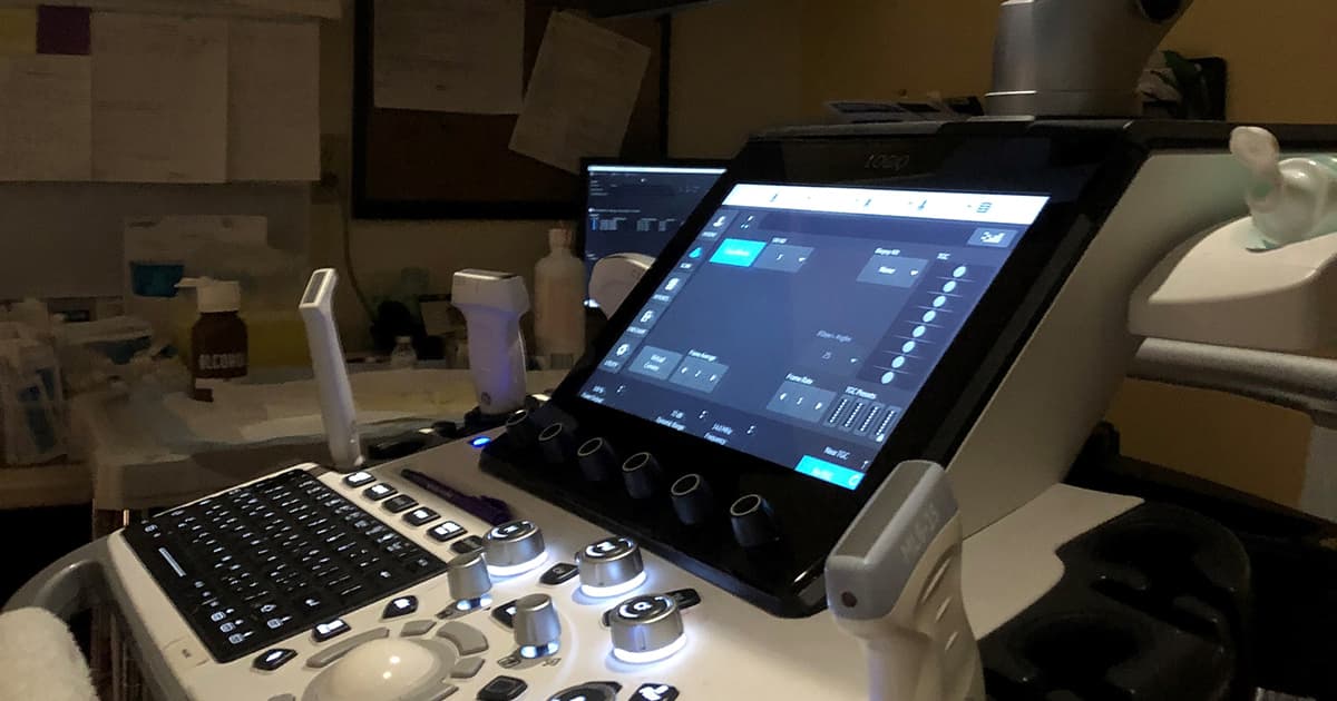 FibroScan & Liver Fibrosis