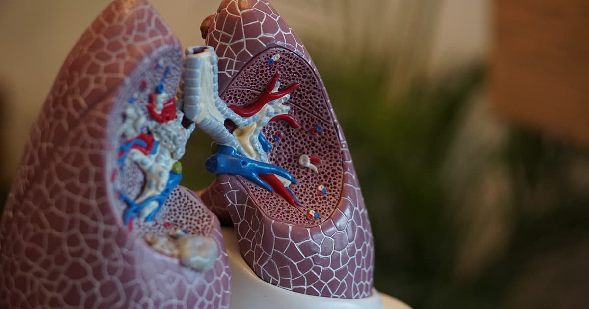 Lung imaging