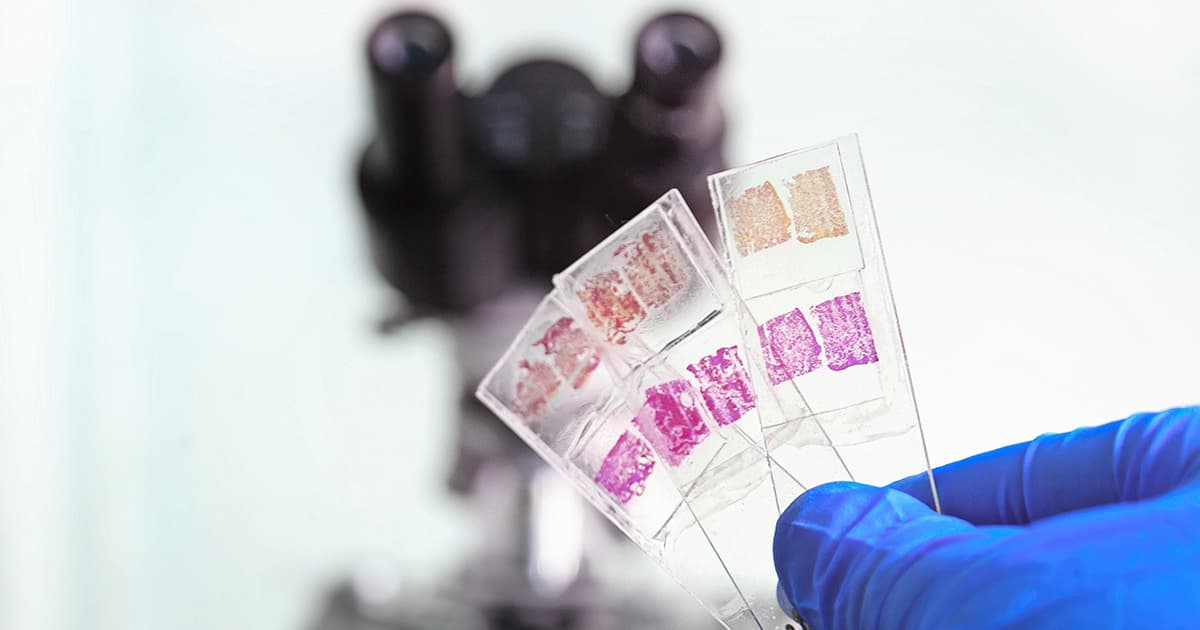 Types of biopsies